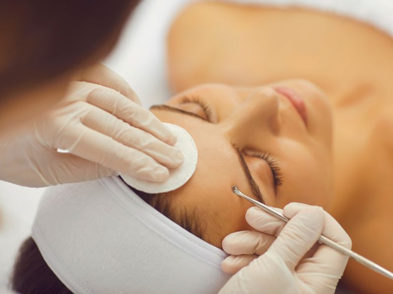 Điều trị mụn